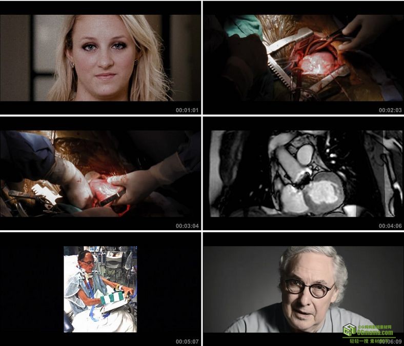 YC0967-国外外国人心脏手术高清实拍视频素材
