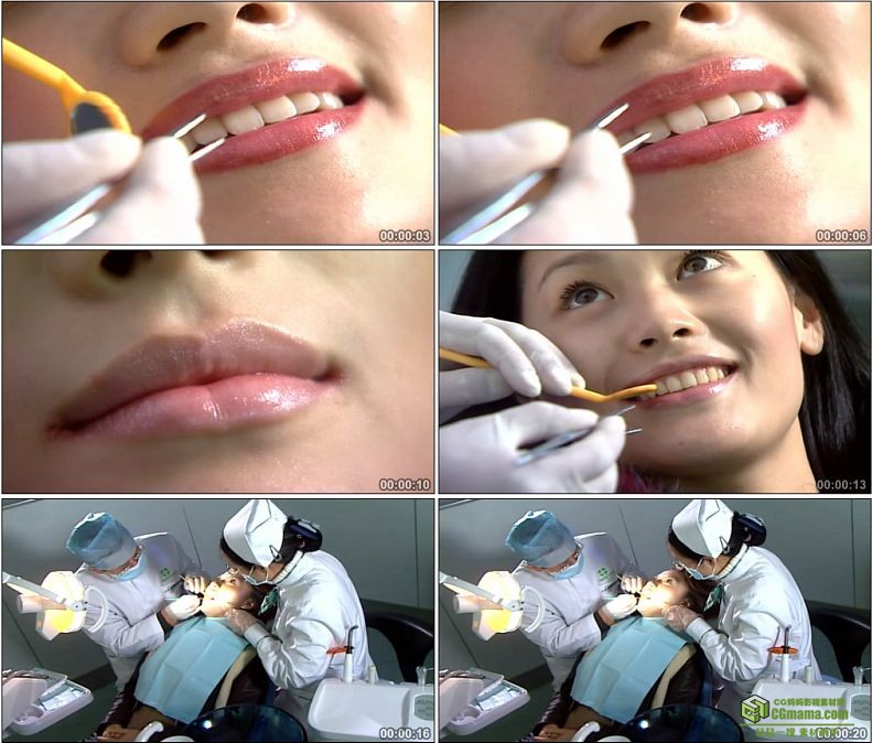 YC1066-医疗检查口腔牙科牙病牙医高清实拍视频素材