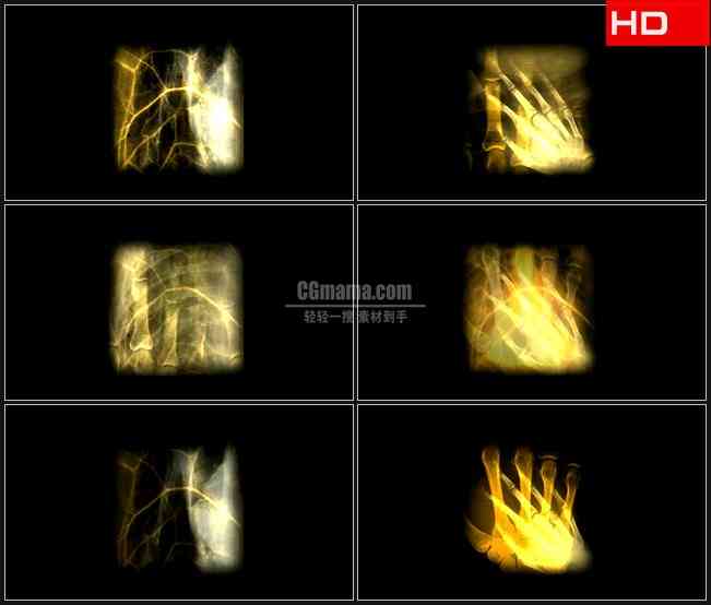 BG0125-手脚退骨骼人体X光片高清LED视频背景素材